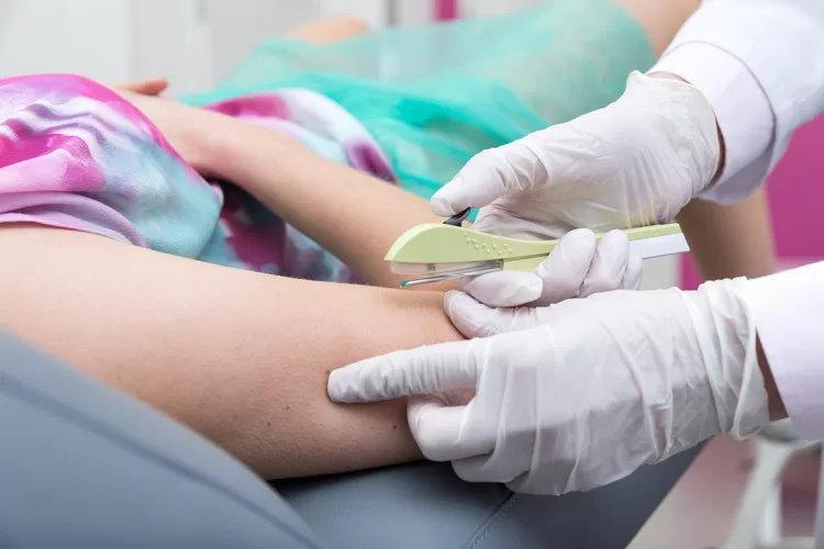 Implantes Hormonais